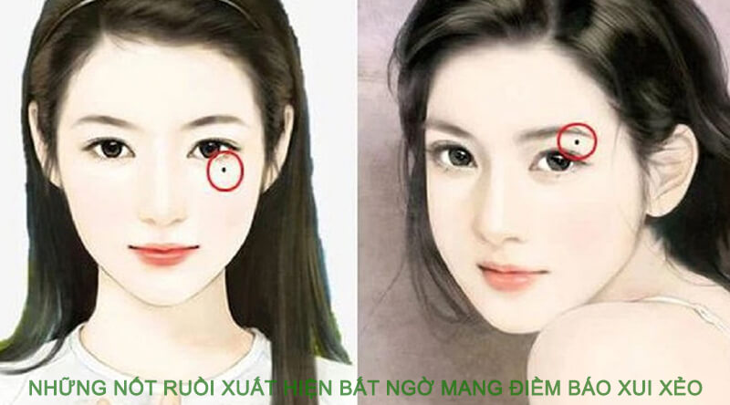 NHỮNG NỐT RUỒI XUẤT HIỆN BẤT NGỜ MANG ĐIỀM BÁO XUI XẺO